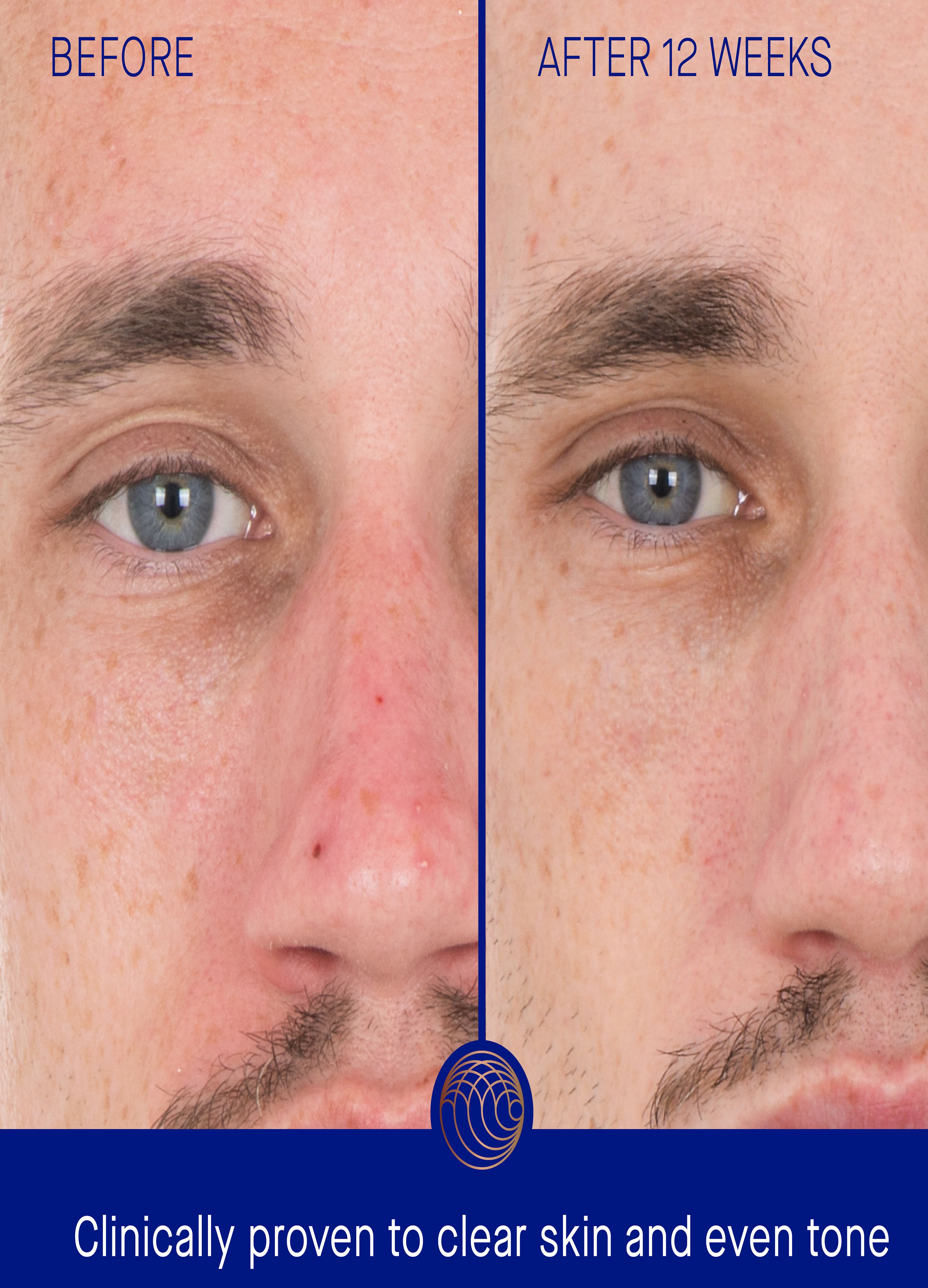 The Retinol Serum 50 ml thumbnail 6